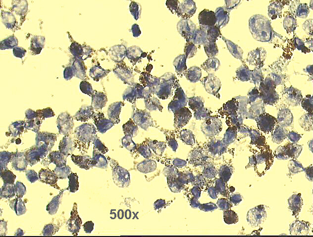 500x Pap staining