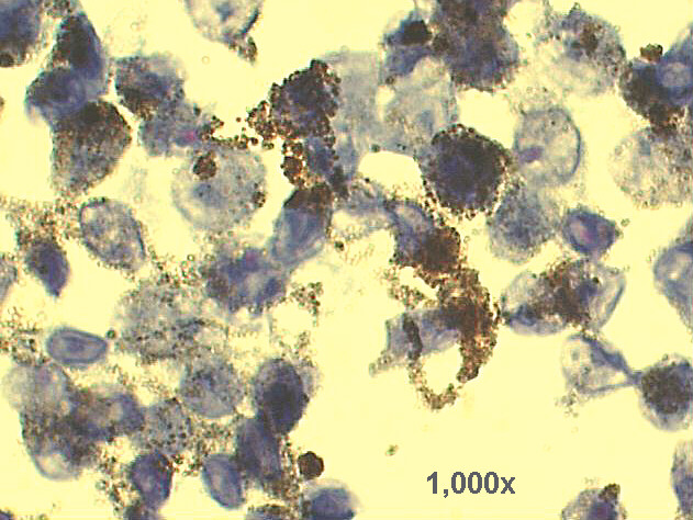 1,000x Pap staining