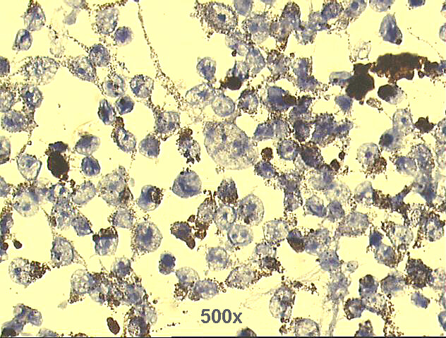 500x Pap staining
