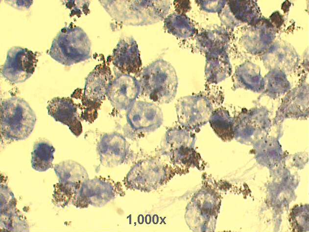 1,000x Pap staining