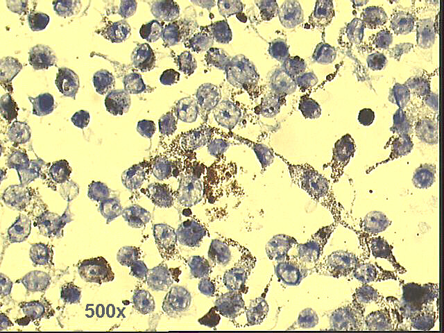500x Pap staining