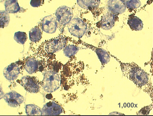 1,000x Pap staining
