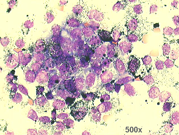 500x M-G-G staining