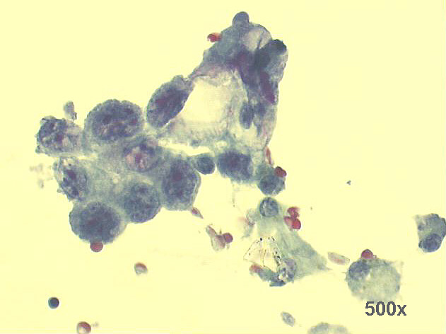 500x Pap staining