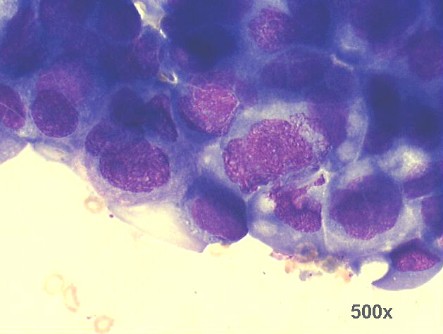 500x M-G-G staining