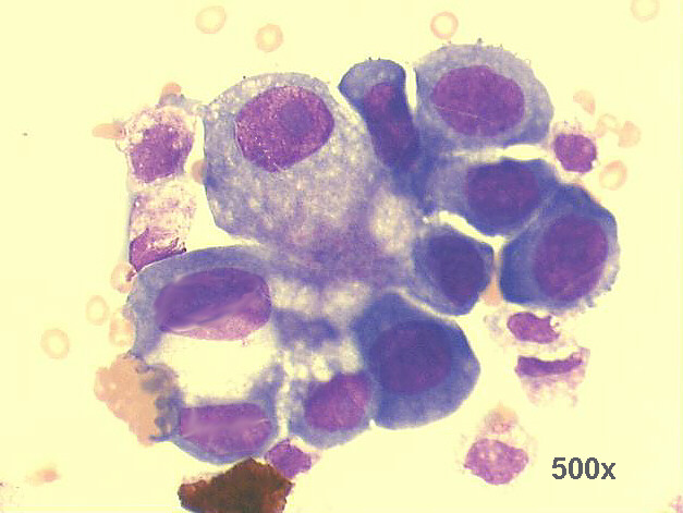 500x M-G-G staining