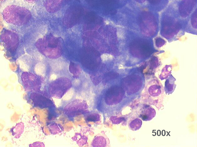 500x M-G-G staining