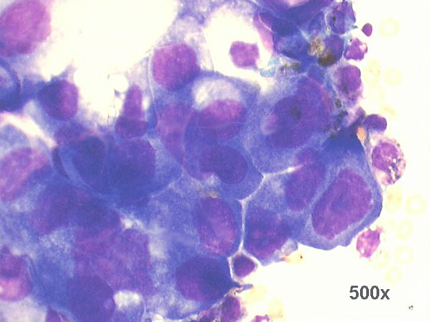 500x M-G-G staining