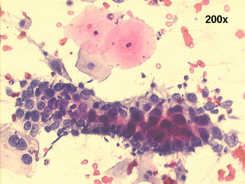 200x Papanicolaou staining
