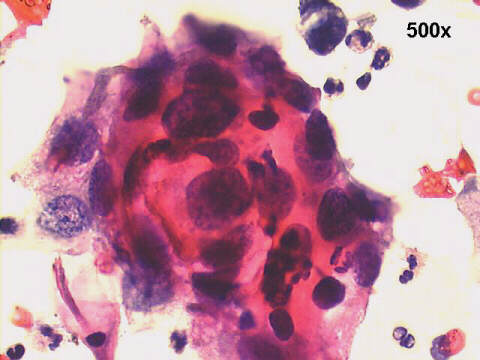 500x Papanicolaou staining