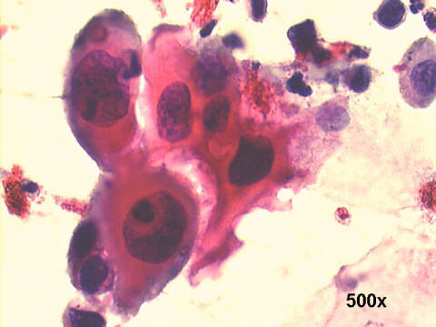 500x Papanicolaou staining