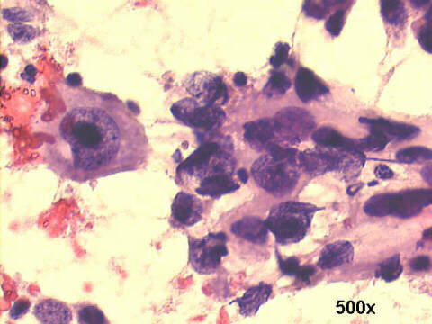 500x Papanicolaou staining