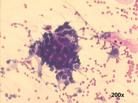 200x Papanicolaou staining