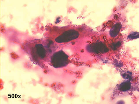 500x Papanicolaou staining