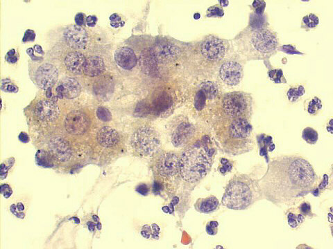 Papanicolaou staining, 500x