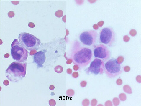 500x Papanicolaou staining