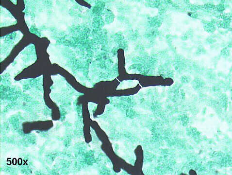Invasive Aspergillosis, 500x Gomori, 45 degree branching large hyphae