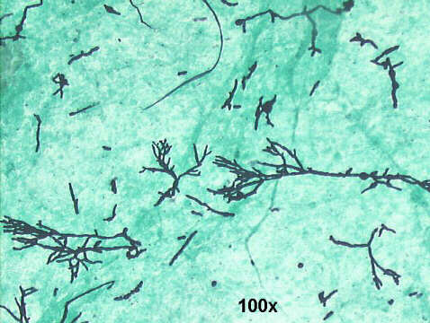 Invasive Aspergillosis, 100x Gomori, large number of hyphae