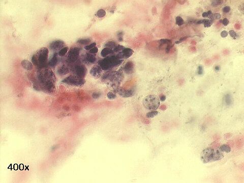400x Papanicolaou staining