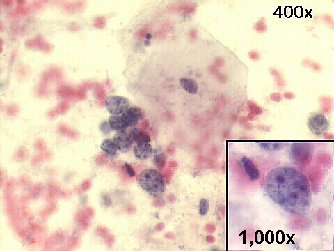 400x Papanicolaou staining