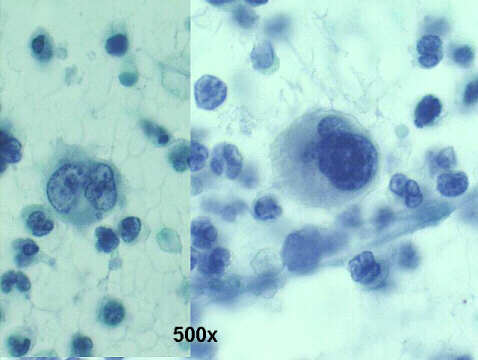 500x Papanicolaou staining