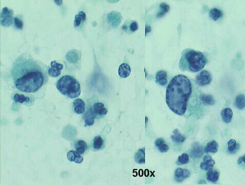 500x Papanicolaou staining