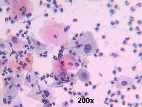 Papanicolaou staining