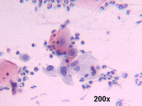 Papanicolaou staining
