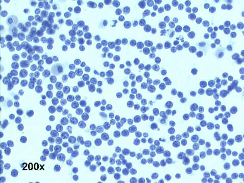 200x Papanicolaou staining