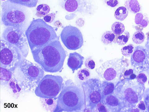 500x M-G-G staining, nuclear enlargement, some gaps between cells