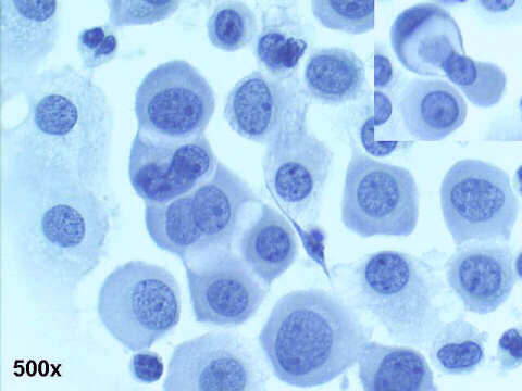 500x Pap staining, mosaic pattern with gaps between the cells, in the inset one cell clasping another