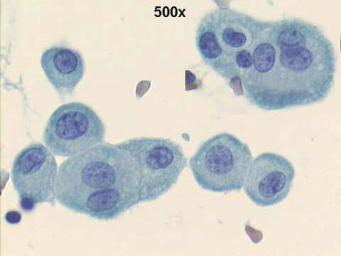 500x Papanicolaou staining