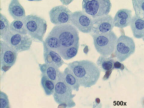 500x Papanicolaou staining