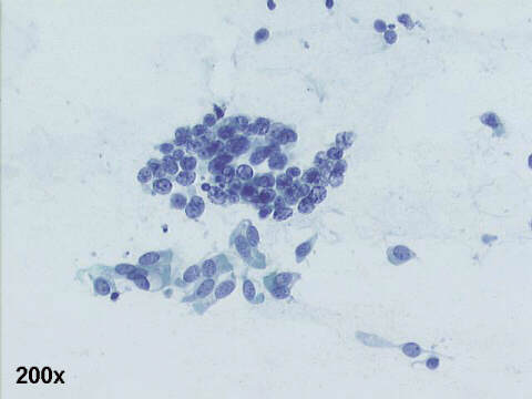 200x Papanicolaou staining