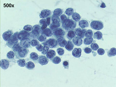 500x Papanicolaou staining