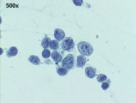 500x Papanicolaou staining
