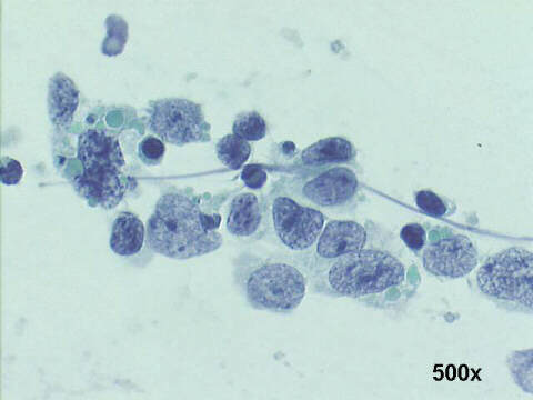 500x Papanicolaou staining