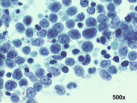 500x Pap staining, notice the dark blue apoptotic bodies.
