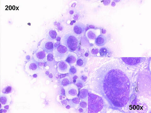 200x and 500x M-G-G staining