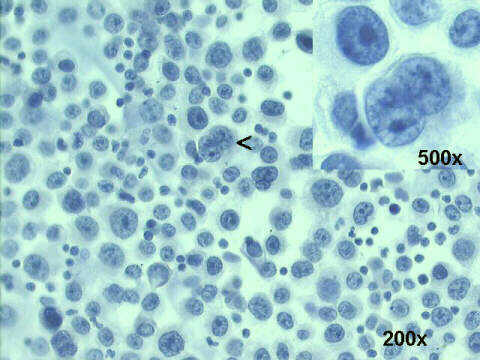 200x and 500x Papanicolaou staining