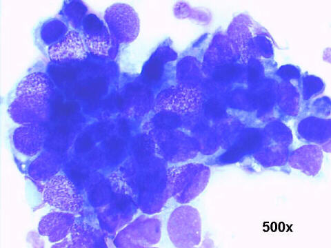 500x M-G-G staining 