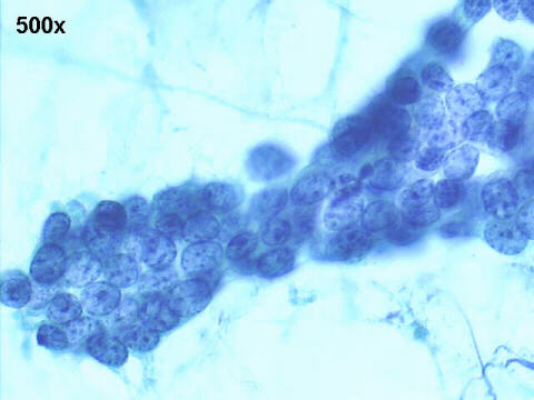 500x Papanicolaou staining