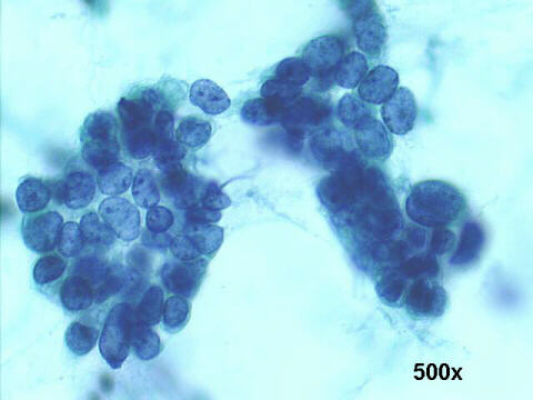 500x Papanicolaou staining