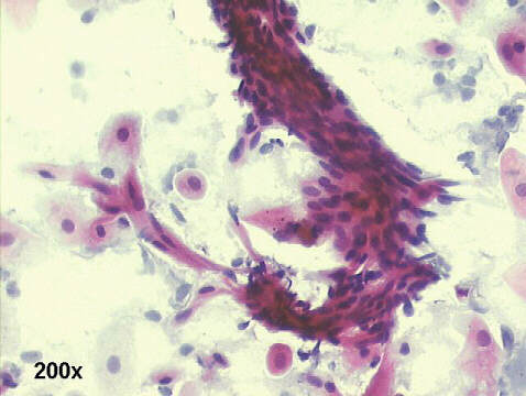 Papanicolaou staining