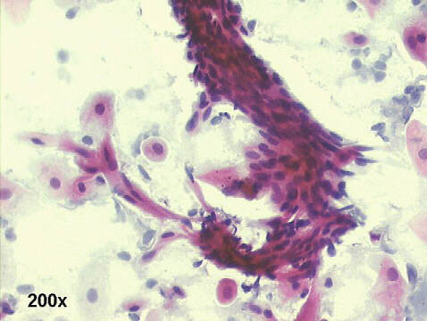 Papanicolaou staining, groups of spindle shaped parabasal cells.