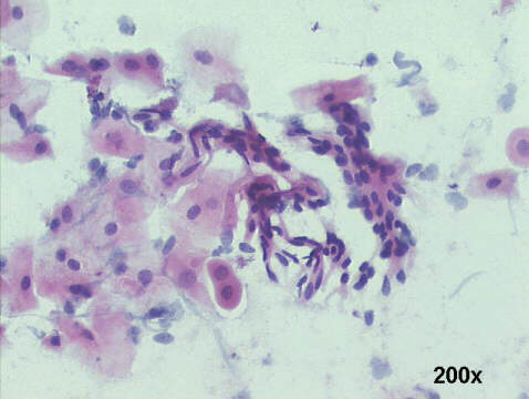Papanicolaou staining