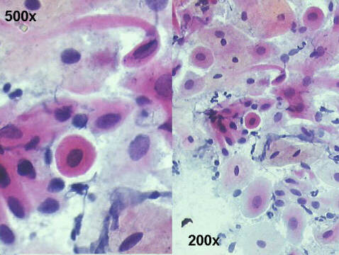 Papanicolaou staining