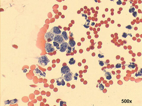500x Papanicolaou staining