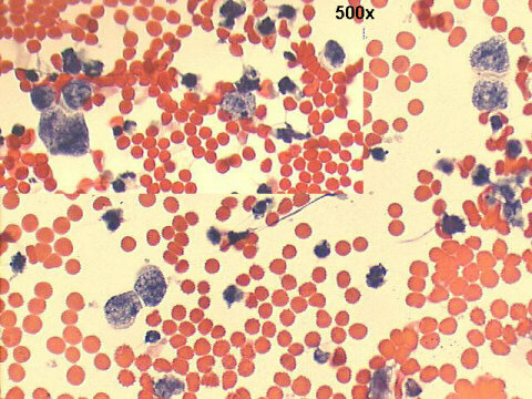 500x Papanicolaou staining