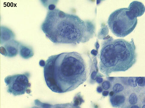 500x Papanicolaou staining